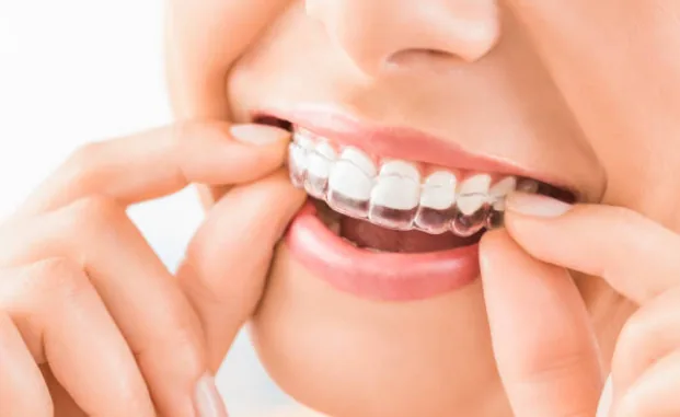 Orthodontie bij Tandartspraktijk Zonnelach Rotterdam